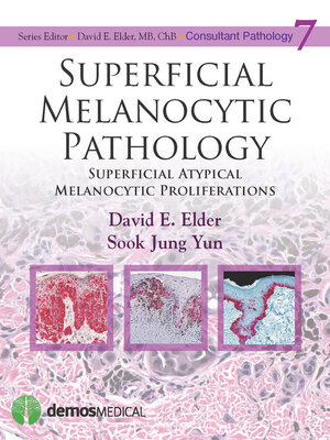 cover image of Superficial Melanocytic Pathology
